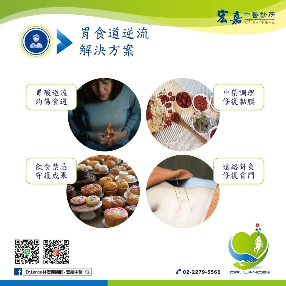 胃食道逆流中醫治療，針灸調理腸胃健康，減少胃酸逆流。