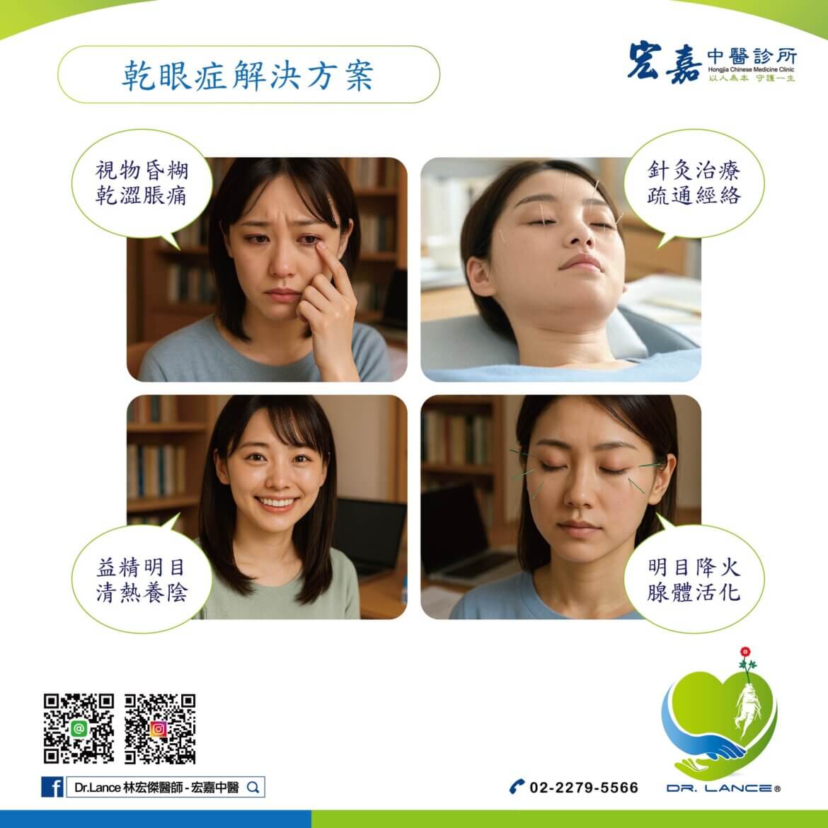 新莊中醫針灸改善乾眼症、眼睛乾澀