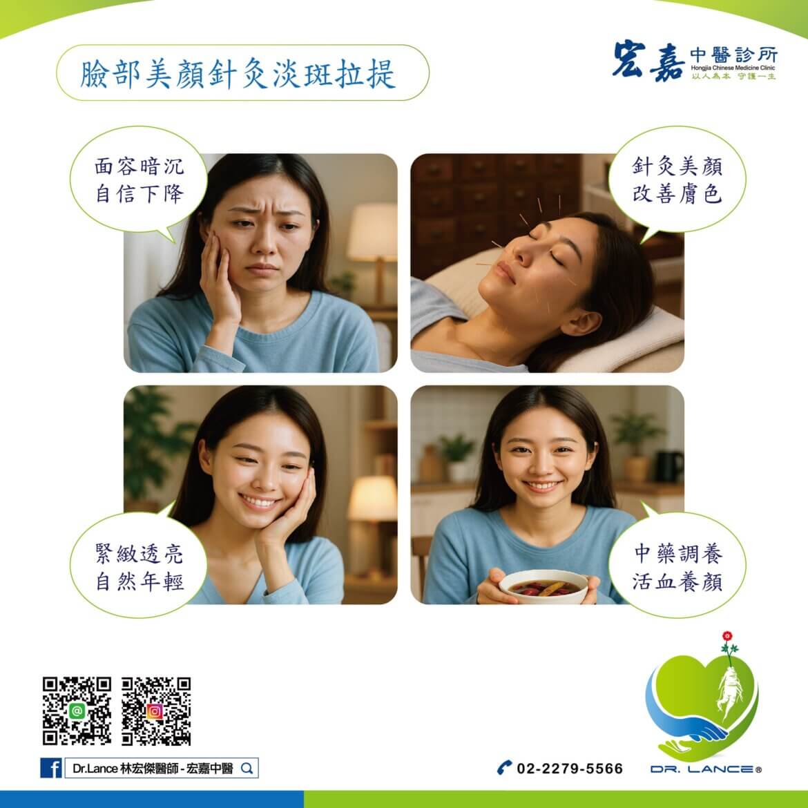 新莊美顏針完整指南－中醫針灸淡斑拉提