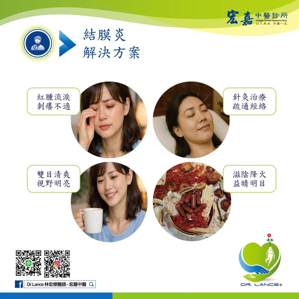 新莊中醫門診評估結膜炎症狀