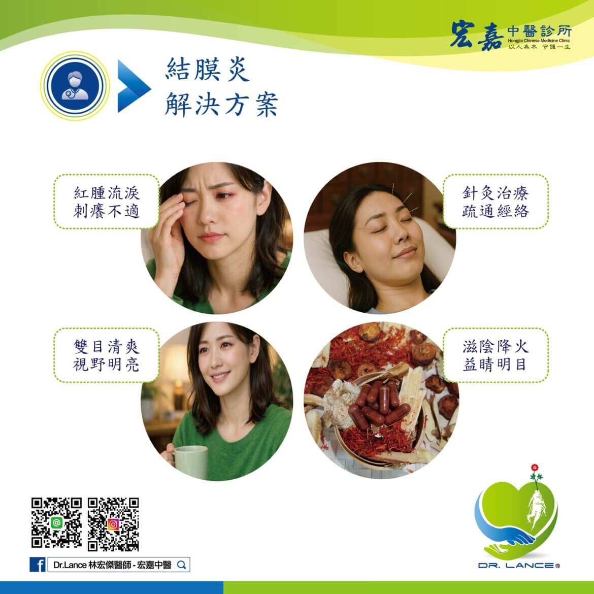 新莊門診醫師說明結膜炎是否會傳染