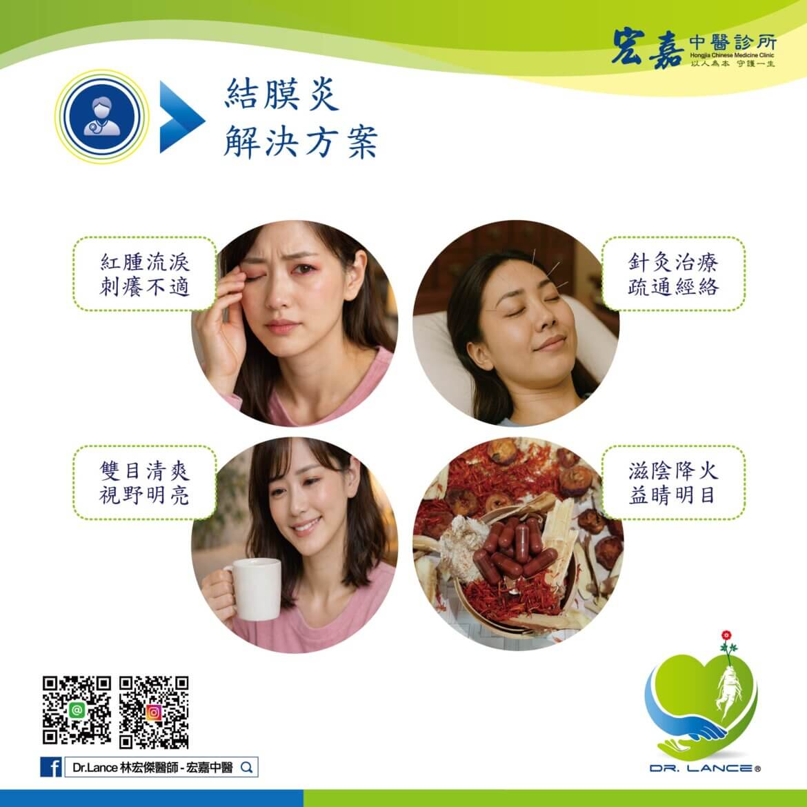 新莊中醫門診評估結膜炎症狀