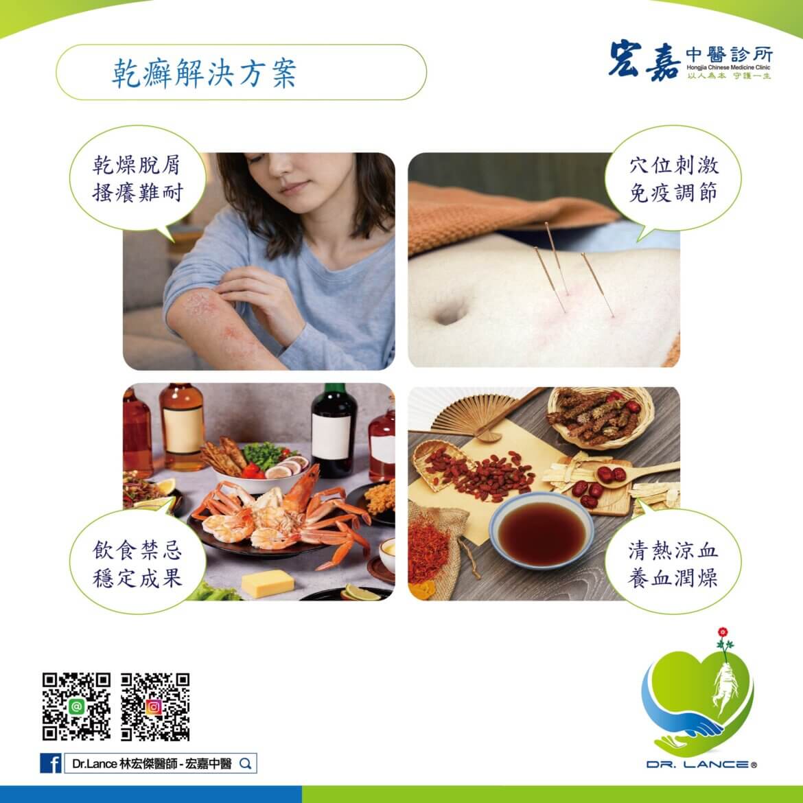 新莊中醫門診說明乾癬症狀