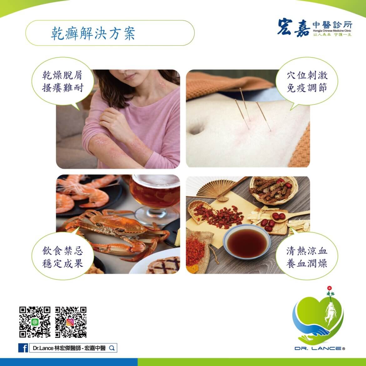 新莊中醫乾癬體質調理門診