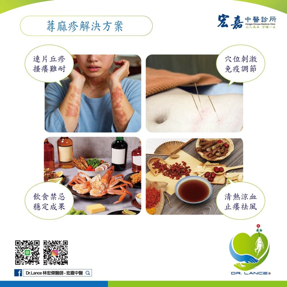 新莊中醫門診說明蕁麻疹症狀與體質調理重點