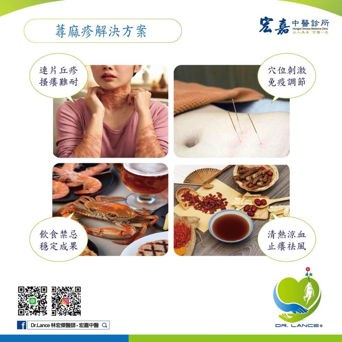 新莊中醫門診說明蕁麻疹止癢方法與體質調理重點