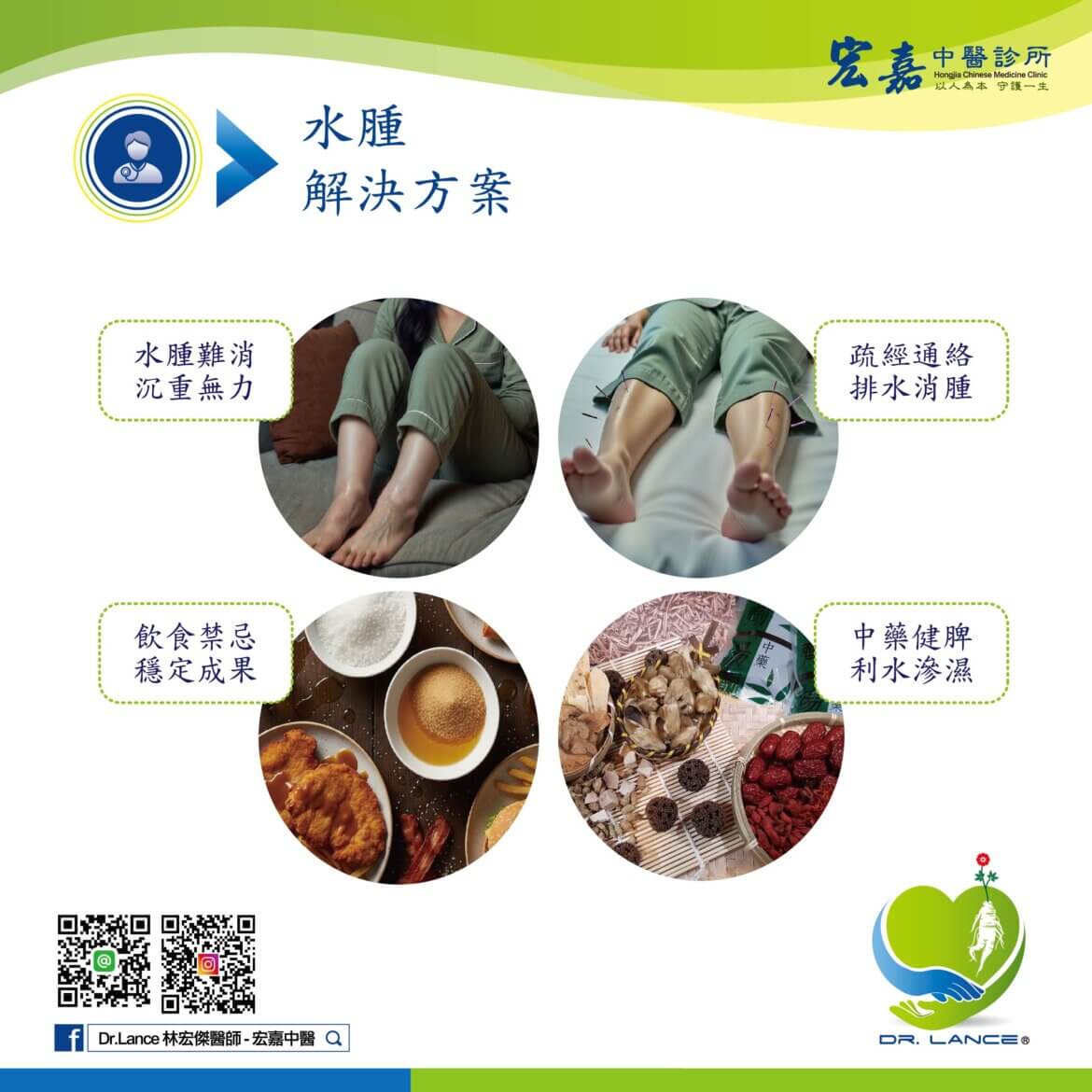 容易水腫體質的判斷與中醫調理方向（門診經驗）