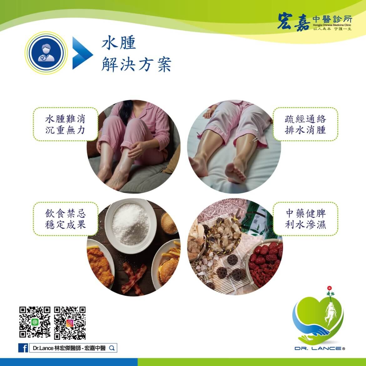 臉部與下肢水腫的判斷重點與安全調整方式